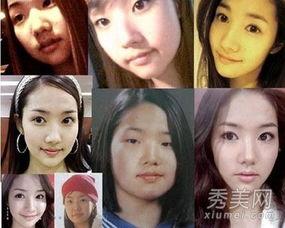 明星整容失败的女明星,盘点那些失败案例的女明星